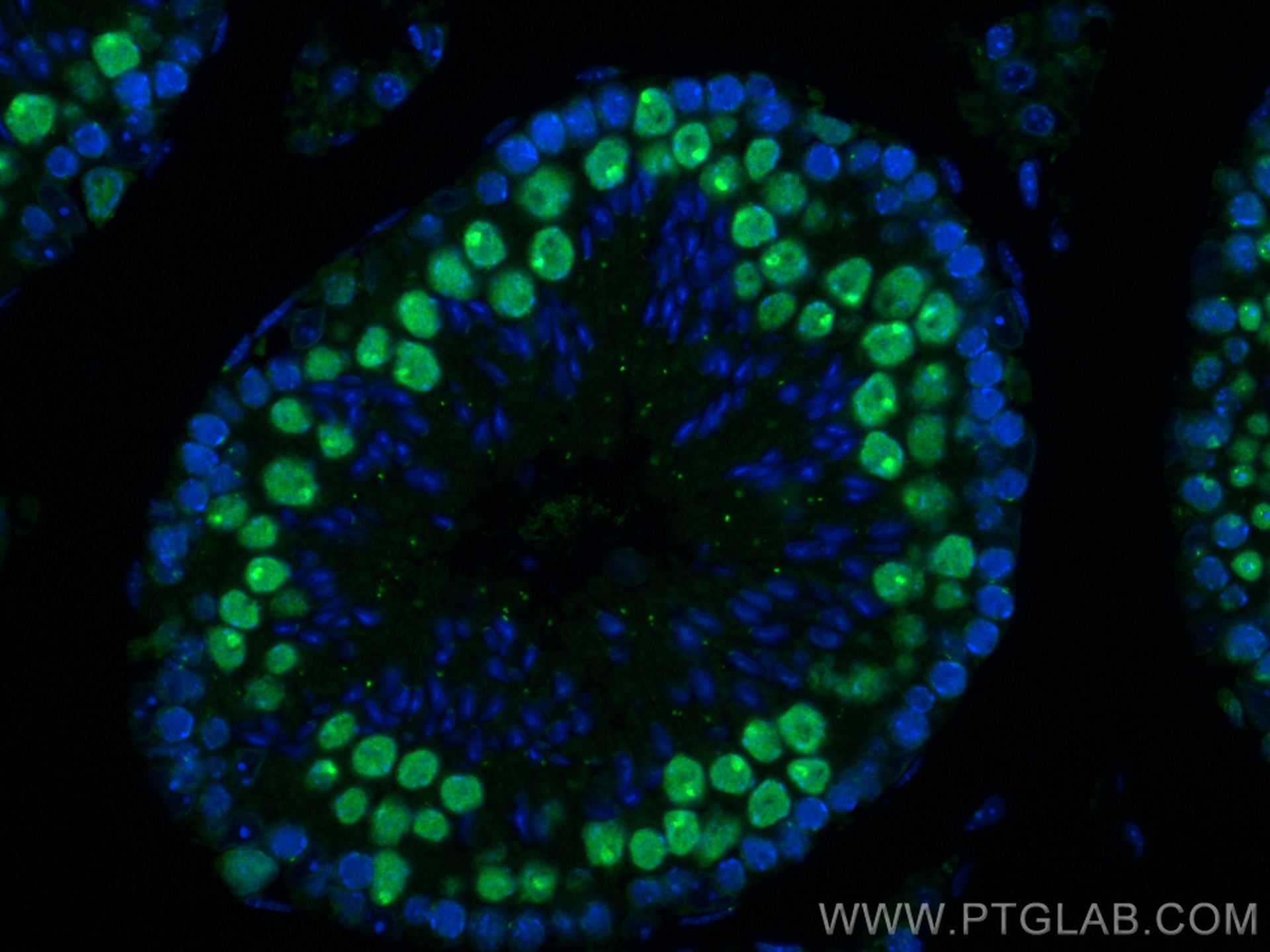 Immunofluorescence (IF) / fluorescent staining of mouse testis tissue using SMC6 Recombinant antibody (83187-3-RR)