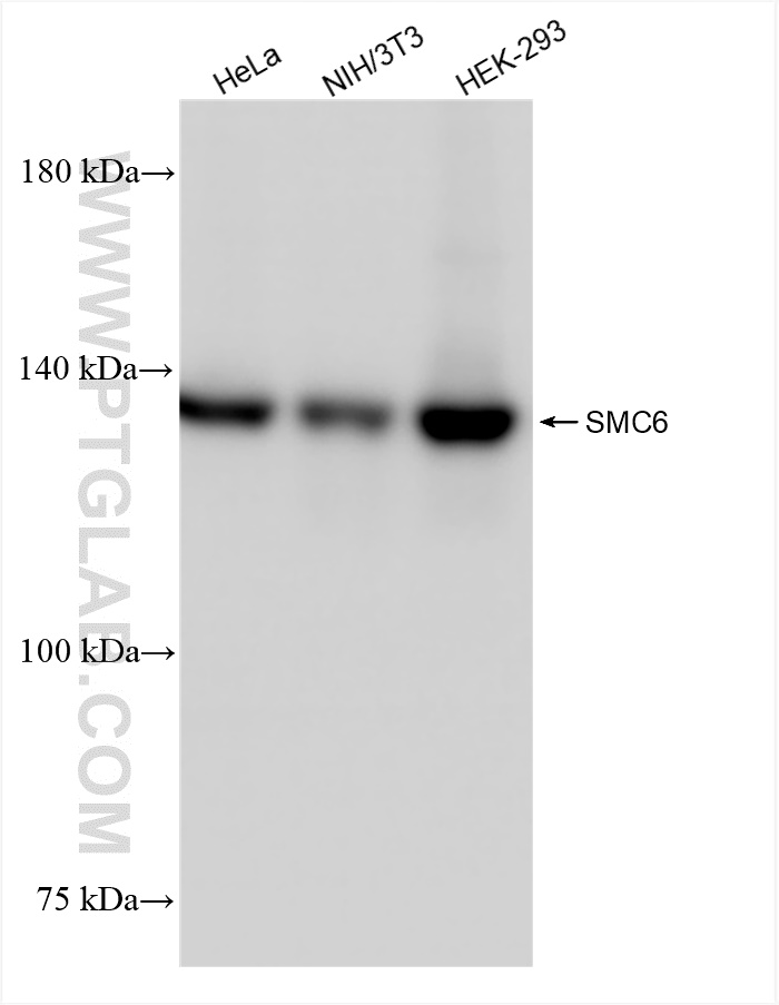 Western Blot (WB) analysis of various lysates using SMC6 Recombinant antibody (83187-3-RR)