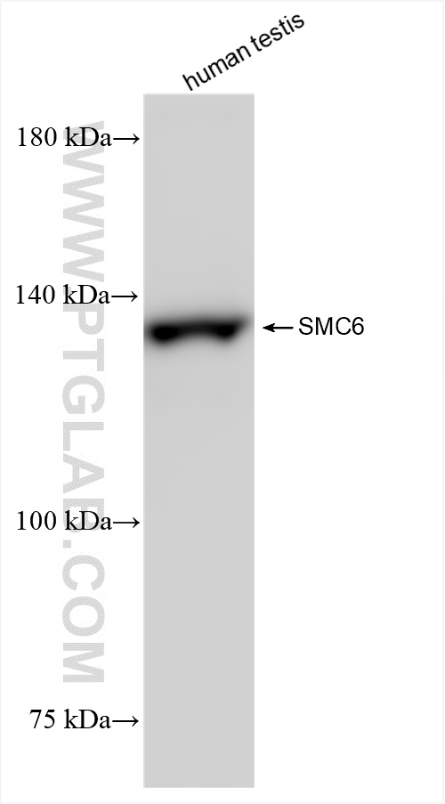 Western Blot (WB) analysis of human testis tissue using SMC6 Recombinant antibody (83187-3-RR)