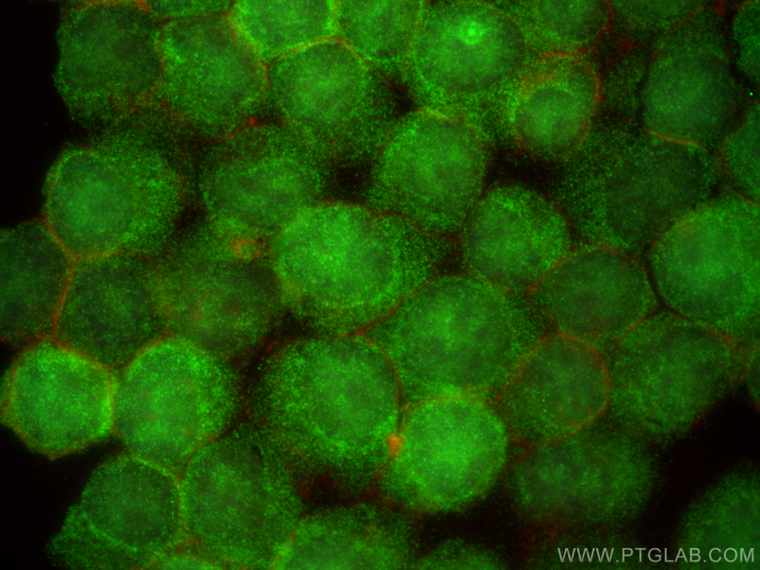 Immunofluorescence (IF) / fluorescent staining of Jurkat cells using SMG5 Polyclonal antibody (12694-1-AP)