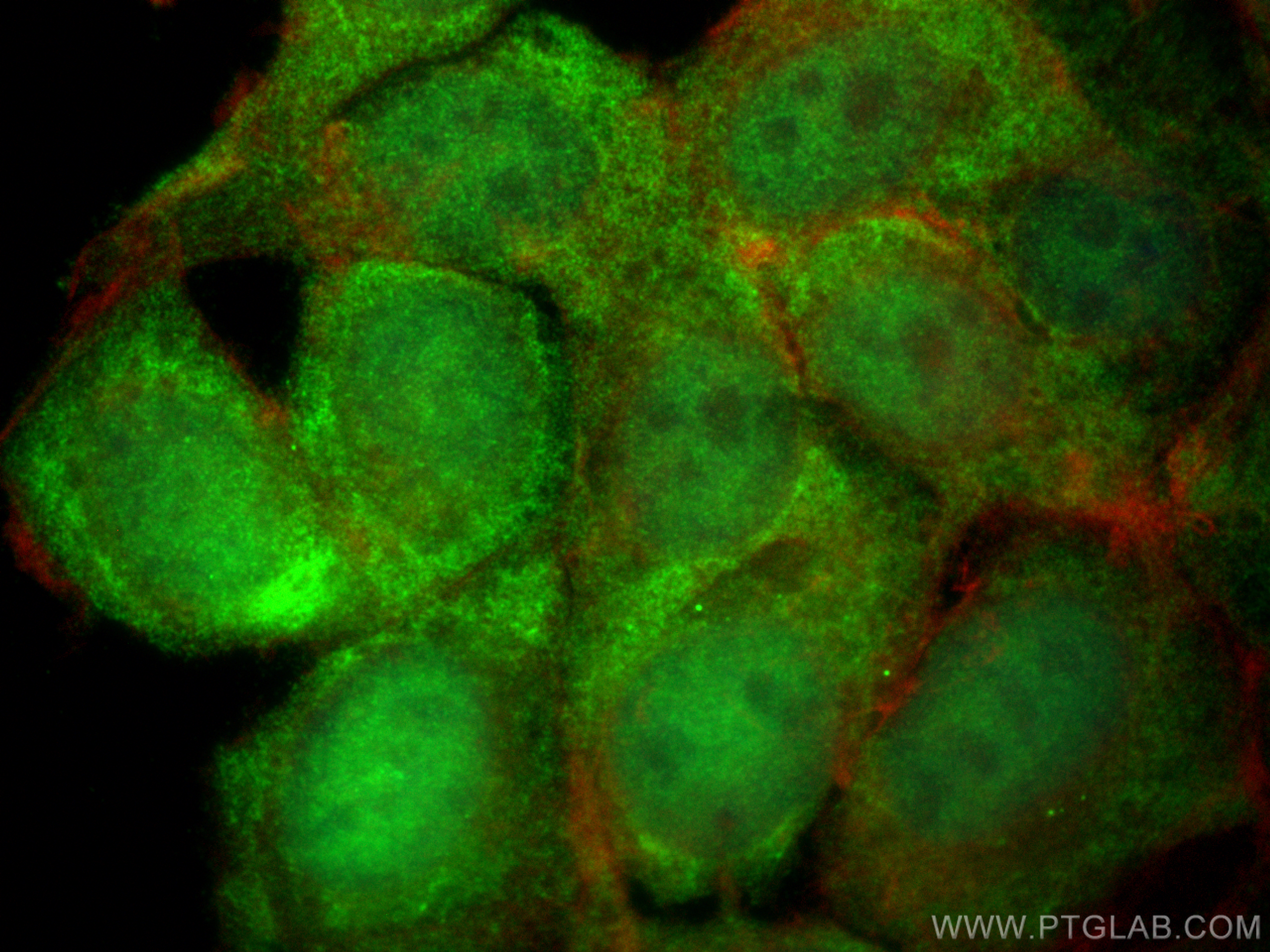 Immunofluorescence (IF) / fluorescent staining of MCF-7 cells using SMG5 Polyclonal antibody (12694-1-AP)