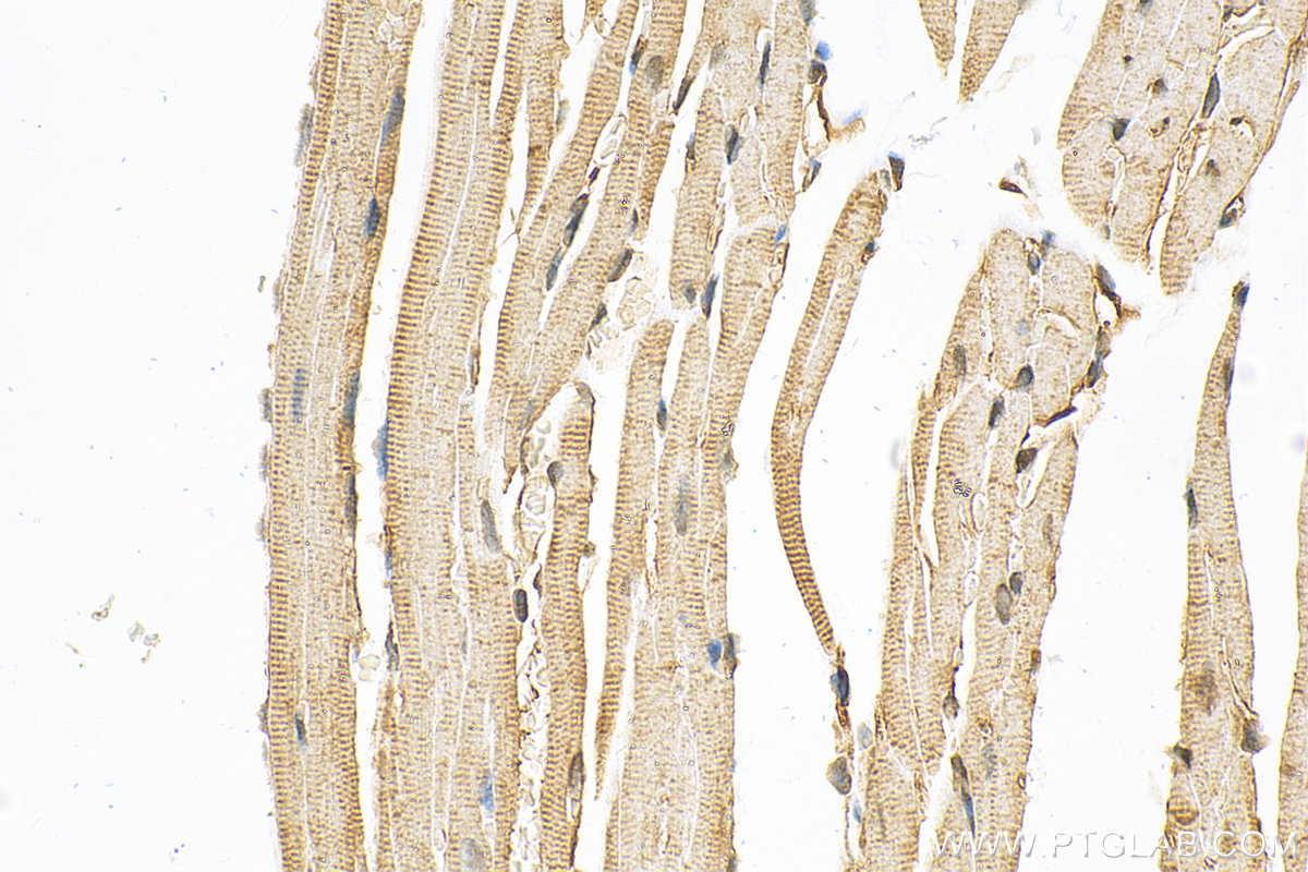 Immunohistochemistry (IHC) staining of mouse heart tissue using SMG5 Polyclonal antibody (12694-1-AP)