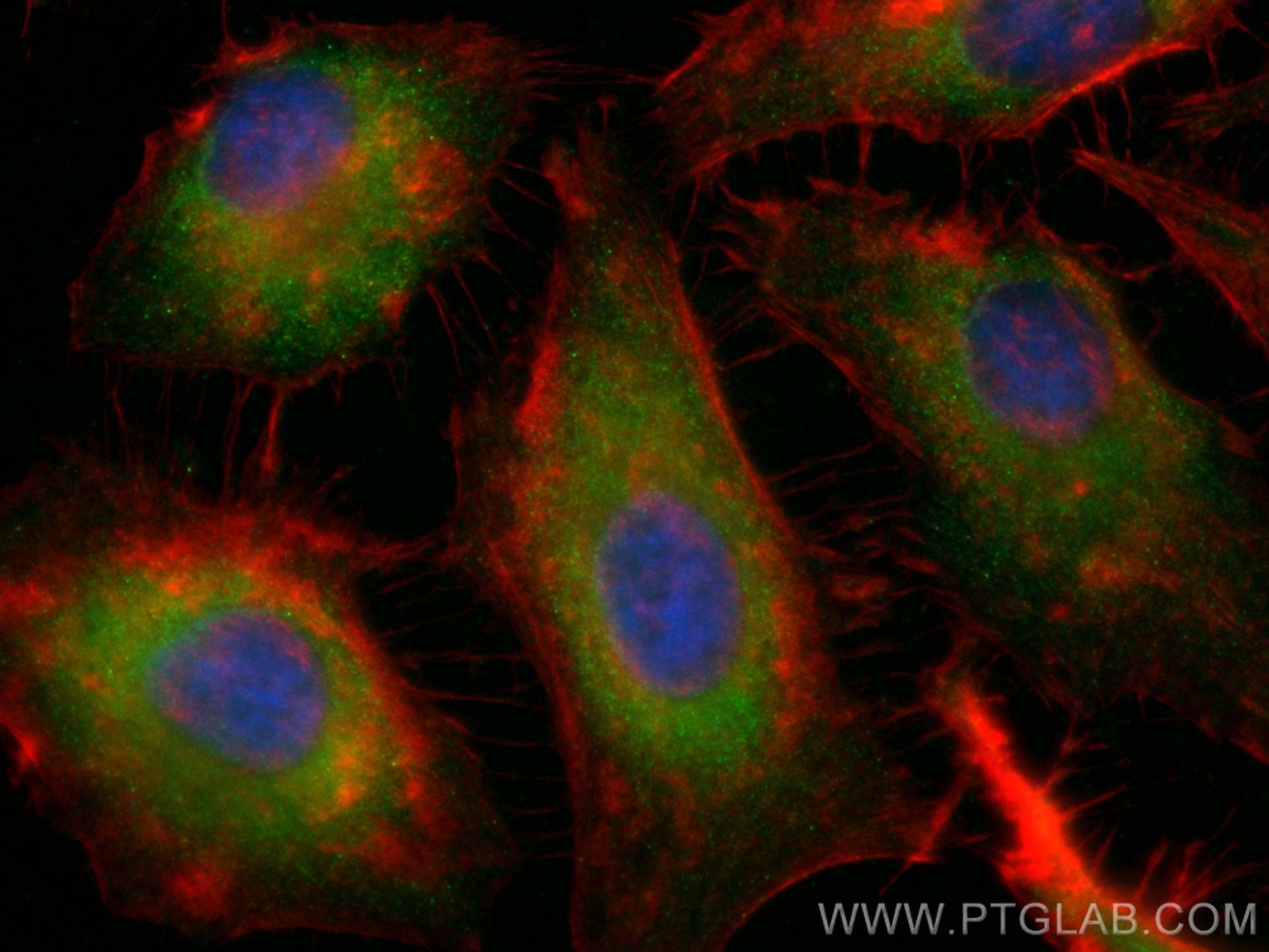 Immunofluorescence (IF) / fluorescent staining of HeLa cells using CoraLite® Plus 488-conjugated SMMHC Polyclonal ant (CL488-21404)