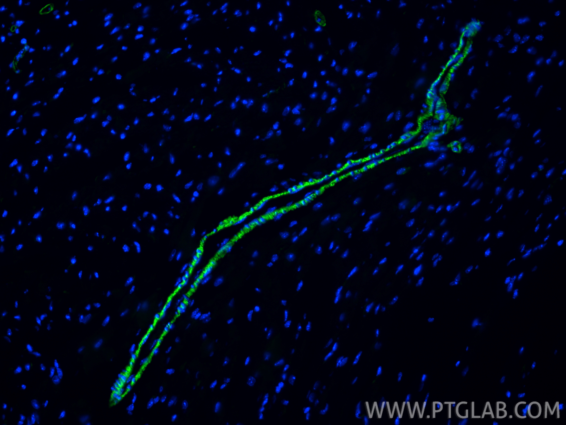 Immunofluorescence (IF) / fluorescent staining of mouse heart tissue using CoraLite® Plus 488-conjugated SMMHC Polyclonal ant (CL488-21404)