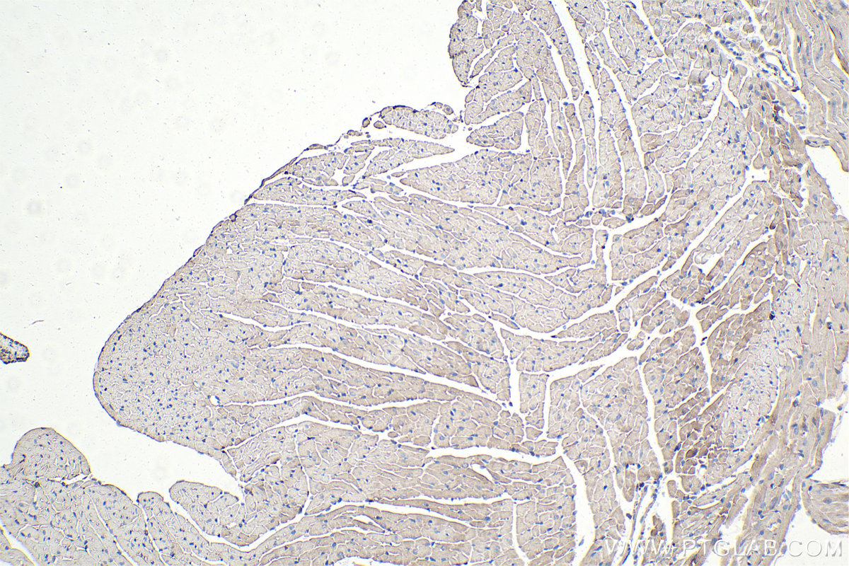 Immunohistochemistry (IHC) staining of mouse heart tissue using SMN-Exon7 Monoclonal antibody (60255-1-Ig)