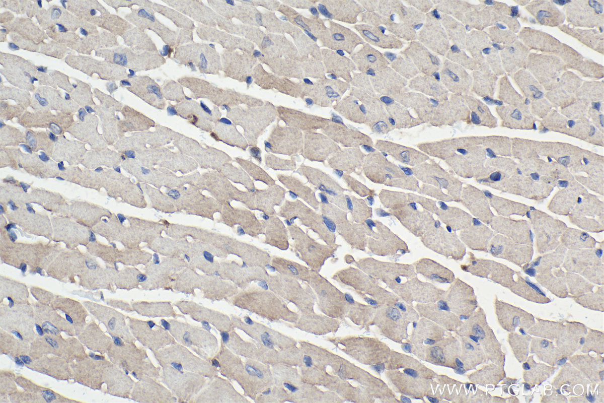 Immunohistochemistry (IHC) staining of mouse heart tissue using SMN-Exon7 Monoclonal antibody (60255-1-Ig)