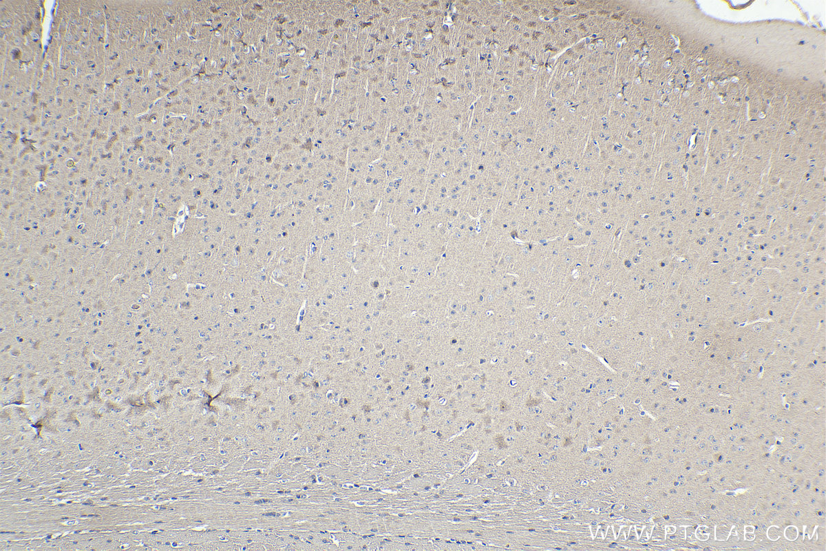 Immunohistochemistry (IHC) staining of mouse brain tissue using SMN-Exon7 Monoclonal antibody (60255-1-Ig)