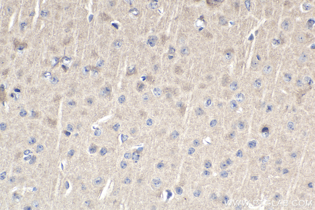 Immunohistochemistry (IHC) staining of mouse brain tissue using SMN-Exon7 Monoclonal antibody (60255-1-Ig)