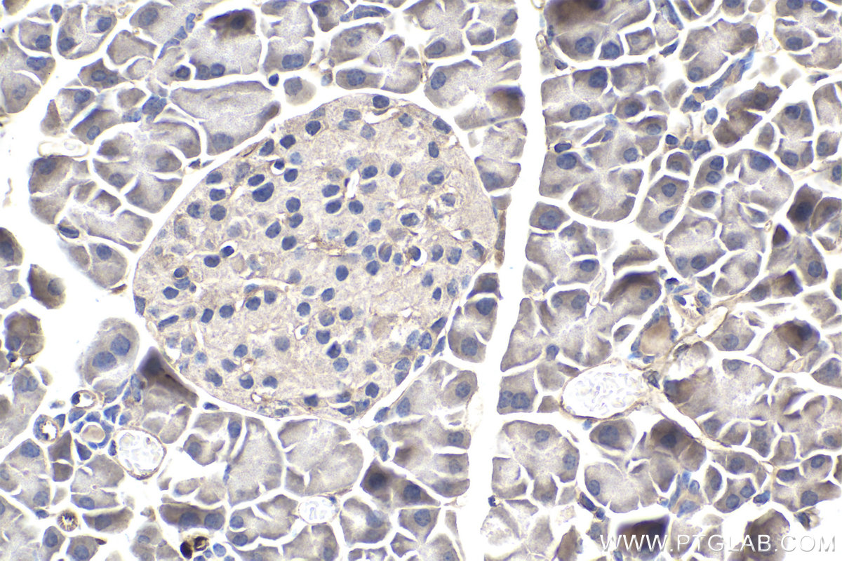 Immunohistochemistry (IHC) staining of mouse pancreas tissue using SMN-Exon7 Monoclonal antibody (60255-1-Ig)