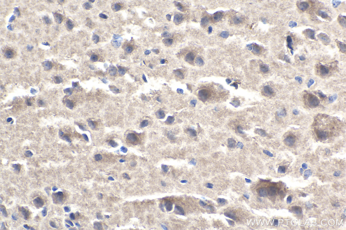 Immunohistochemistry (IHC) staining of rat brain tissue using SMN-Exon7 Monoclonal antibody (60255-1-Ig)