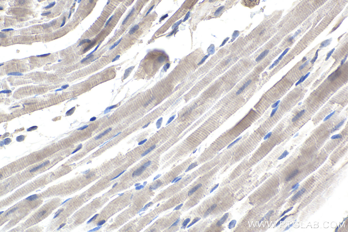 Immunohistochemistry (IHC) staining of rat heart tissue using SMN-Exon7 Monoclonal antibody (60255-1-Ig)