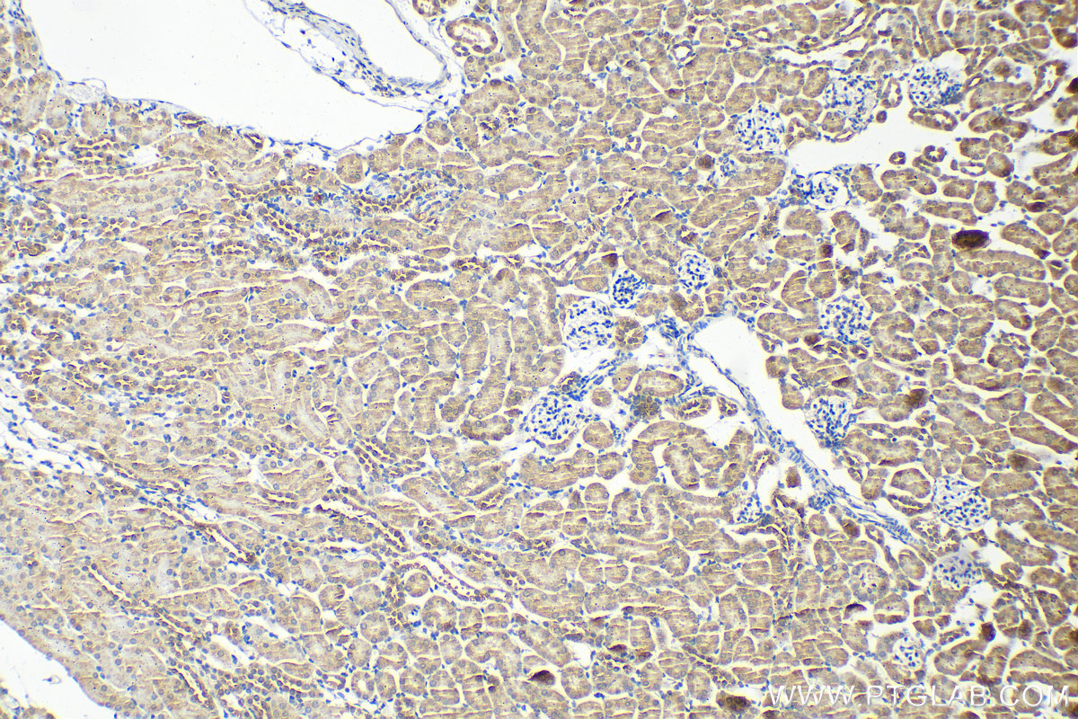 Immunohistochemistry (IHC) staining of mouse kidney tissue using SMN Polyclonal antibody (11708-1-AP)