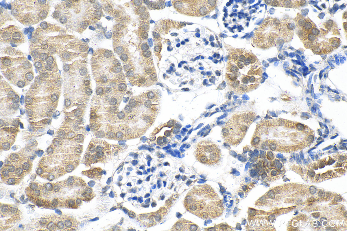 Immunohistochemistry (IHC) staining of mouse kidney tissue using SMN Polyclonal antibody (11708-1-AP)