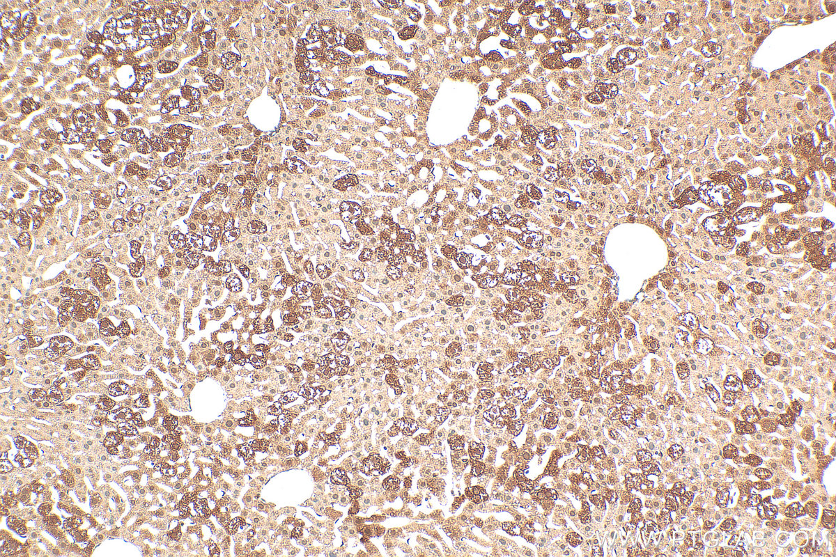 Immunohistochemistry (IHC) staining of mouse liver tissue using SMN Polyclonal antibody (11708-1-AP)