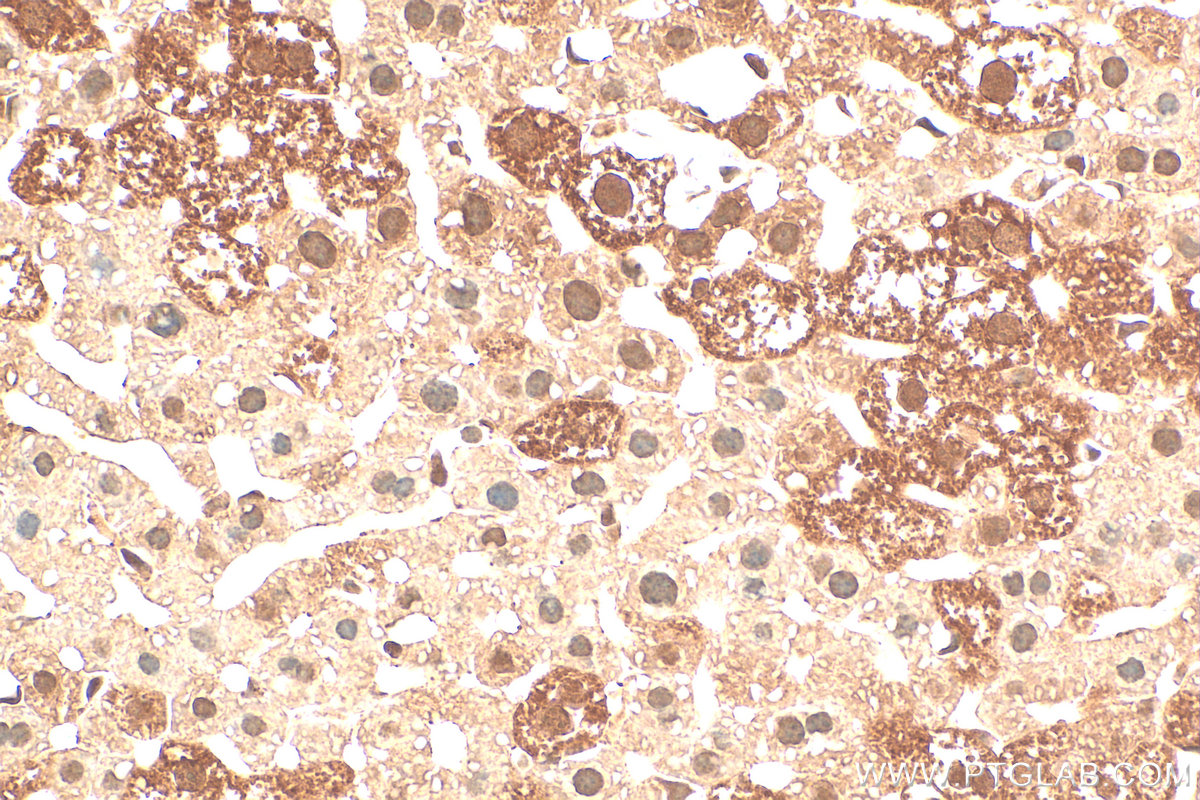 Immunohistochemistry (IHC) staining of mouse liver tissue using SMN Polyclonal antibody (11708-1-AP)