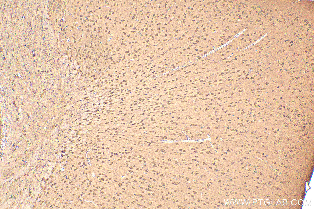 Immunohistochemistry (IHC) staining of mouse brain tissue using SMN Polyclonal antibody (11708-1-AP)