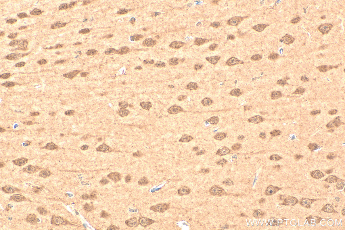 Immunohistochemistry (IHC) staining of mouse brain tissue using SMN Polyclonal antibody (11708-1-AP)