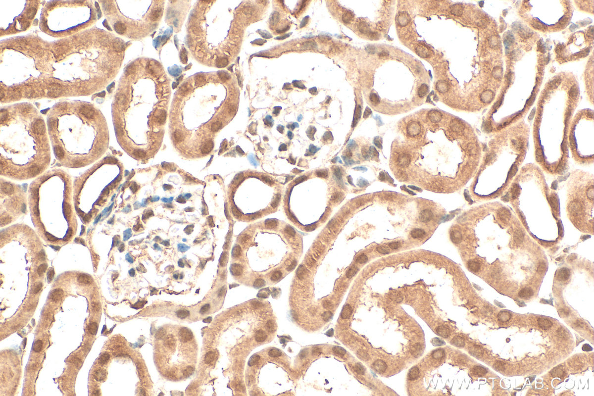 Immunohistochemistry (IHC) staining of mouse kidney tissue using SMN Polyclonal antibody (11708-1-AP)