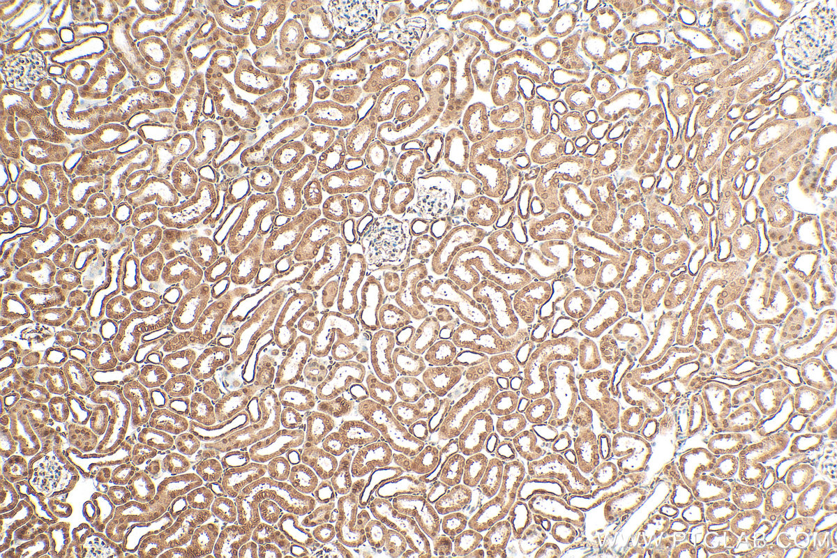 Immunohistochemistry (IHC) staining of mouse kidney tissue using SMN Polyclonal antibody (11708-1-AP)