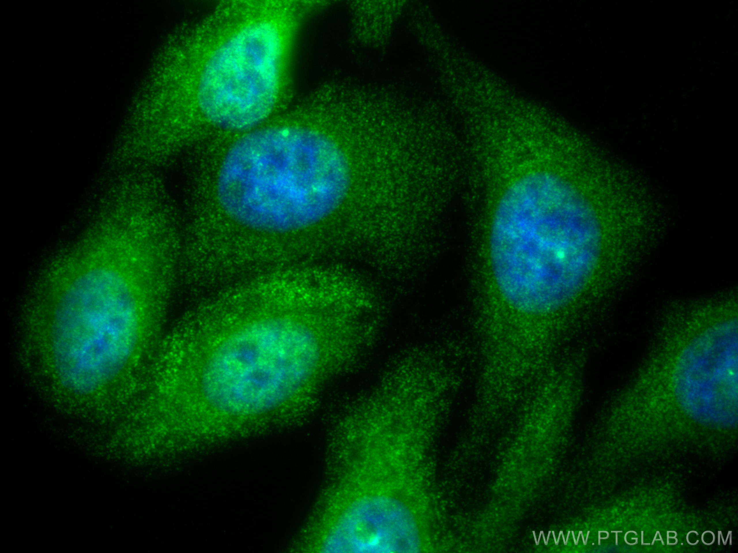 Immunofluorescence (IF) / fluorescent staining of HepG2 cells using SMN (Human-Specific) Monoclonal antibody (60154-1-Ig)