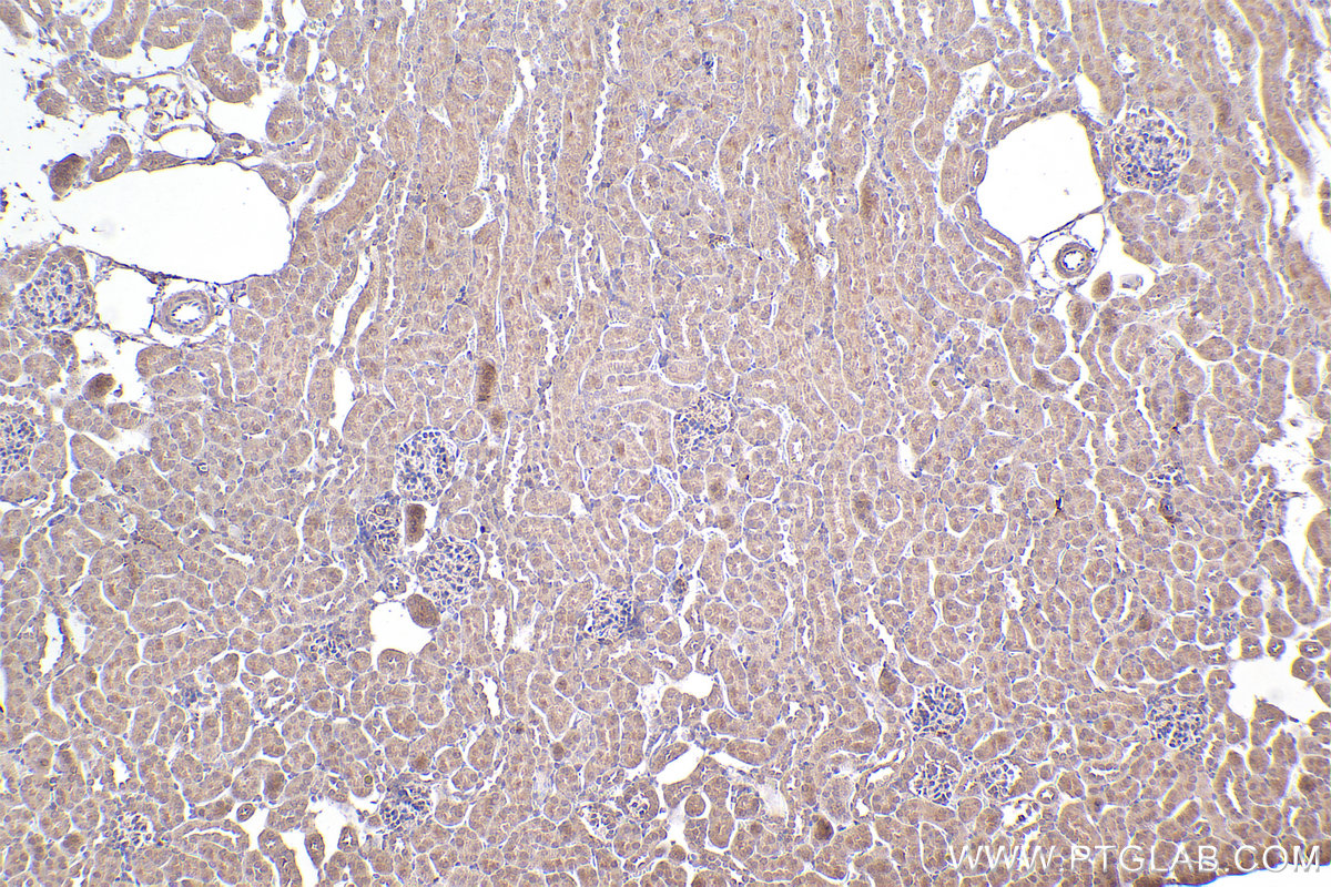 Immunohistochemistry (IHC) staining of mouse kidney tissue using SMN (Human,Mouse,Rat) Monoclonal antibody (60154-2-Ig)