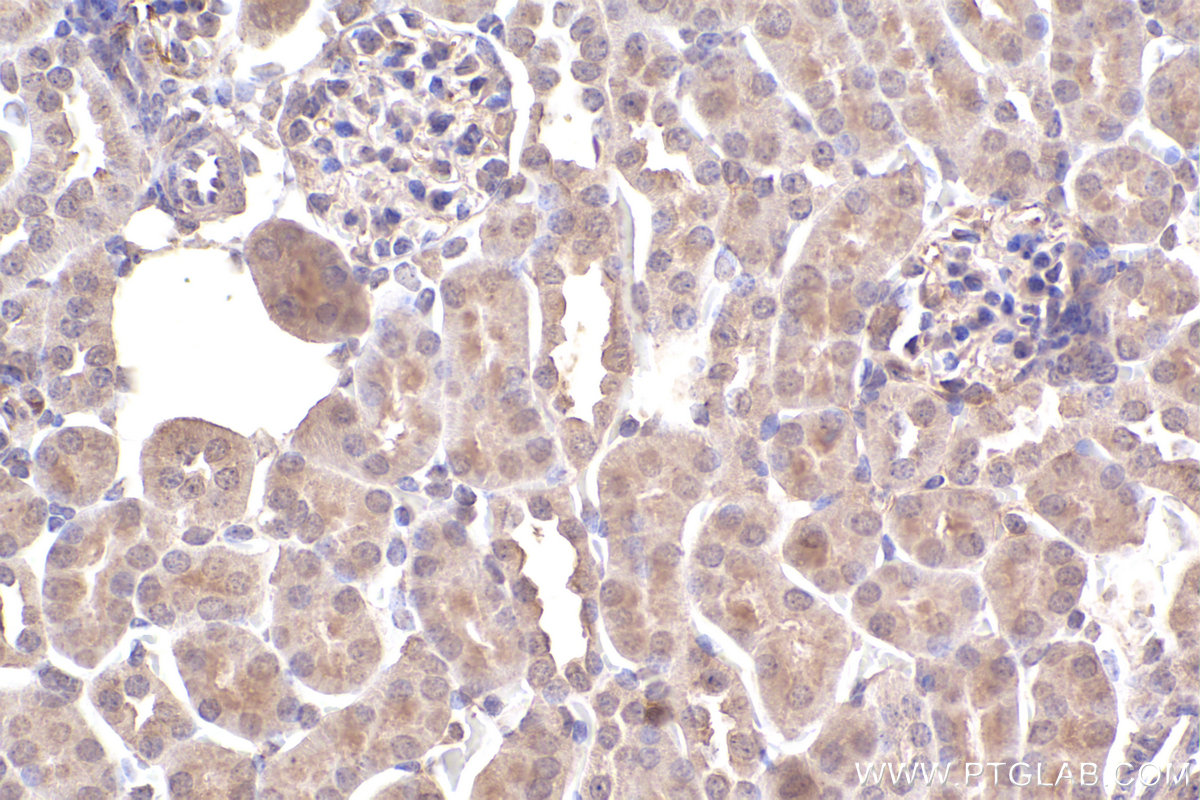 Immunohistochemistry (IHC) staining of mouse kidney tissue using SMN (Human,Mouse,Rat) Monoclonal antibody (60154-2-Ig)