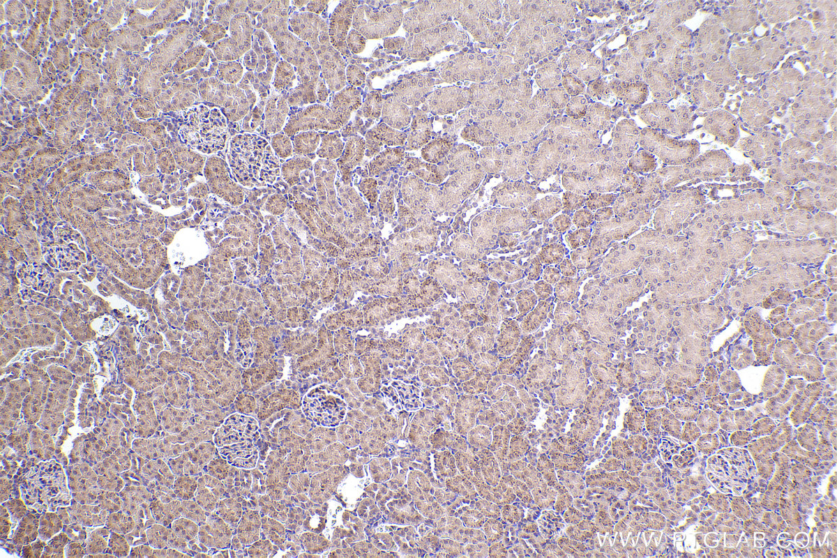 Immunohistochemistry (IHC) staining of rat kidney tissue using SMN (Human,Mouse,Rat) Monoclonal antibody (60154-2-Ig)