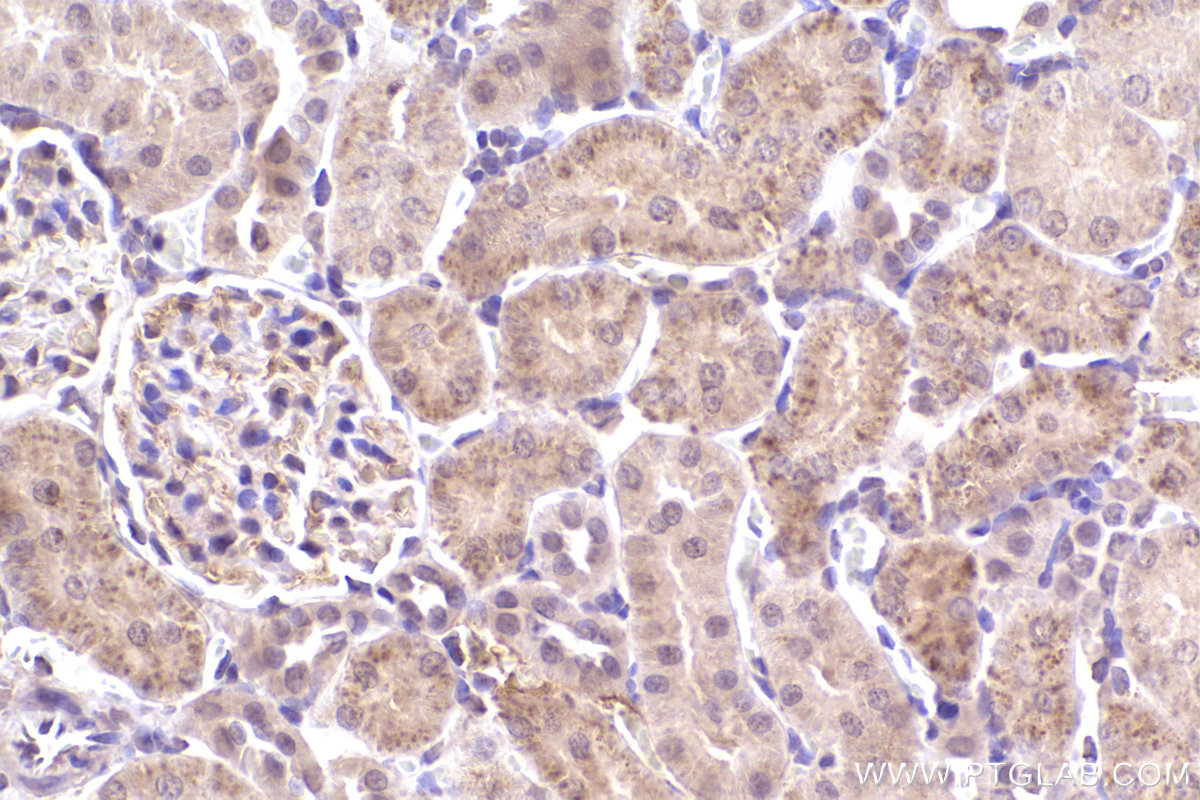 Immunohistochemistry (IHC) staining of rat kidney tissue using SMN (Human,Mouse,Rat) Monoclonal antibody (60154-2-Ig)