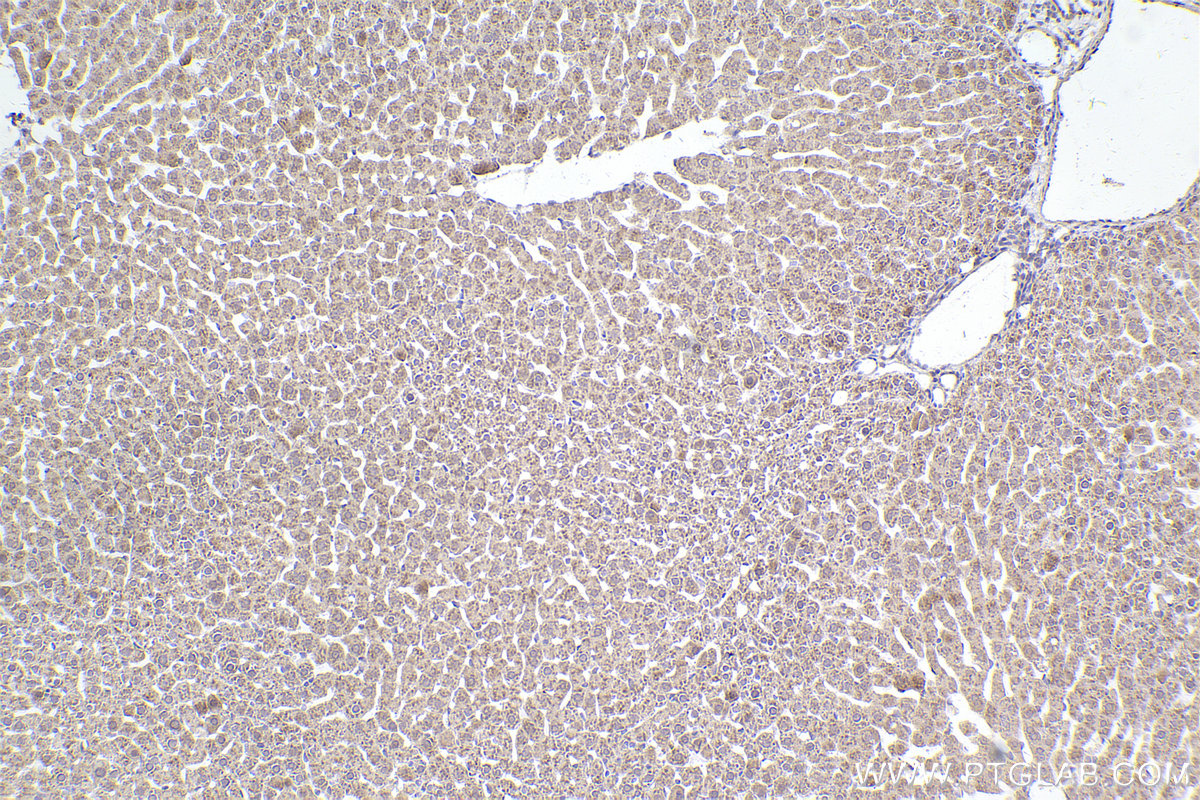 Immunohistochemistry (IHC) staining of rat liver tissue using SMN (Human,Mouse,Rat) Monoclonal antibody (60154-2-Ig)