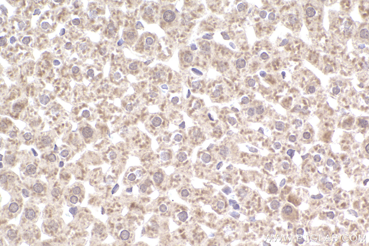 Immunohistochemistry (IHC) staining of rat liver tissue using SMN (Human,Mouse,Rat) Monoclonal antibody (60154-2-Ig)