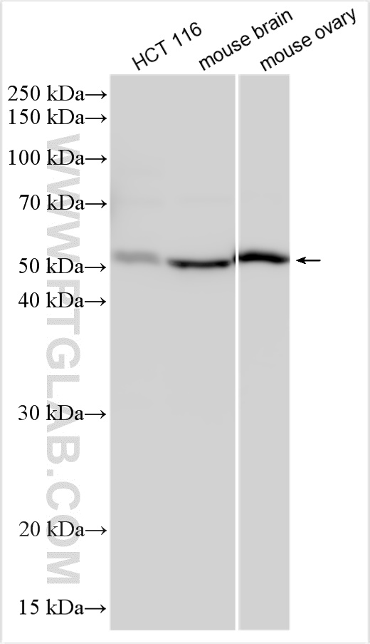 Western Blot (WB) analysis of various lysates using SMOC2 Polyclonal antibody (31063-1-AP)