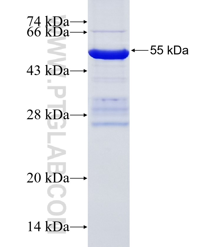 SMOC2 fusion protein Ag34966 SDS-PAGE