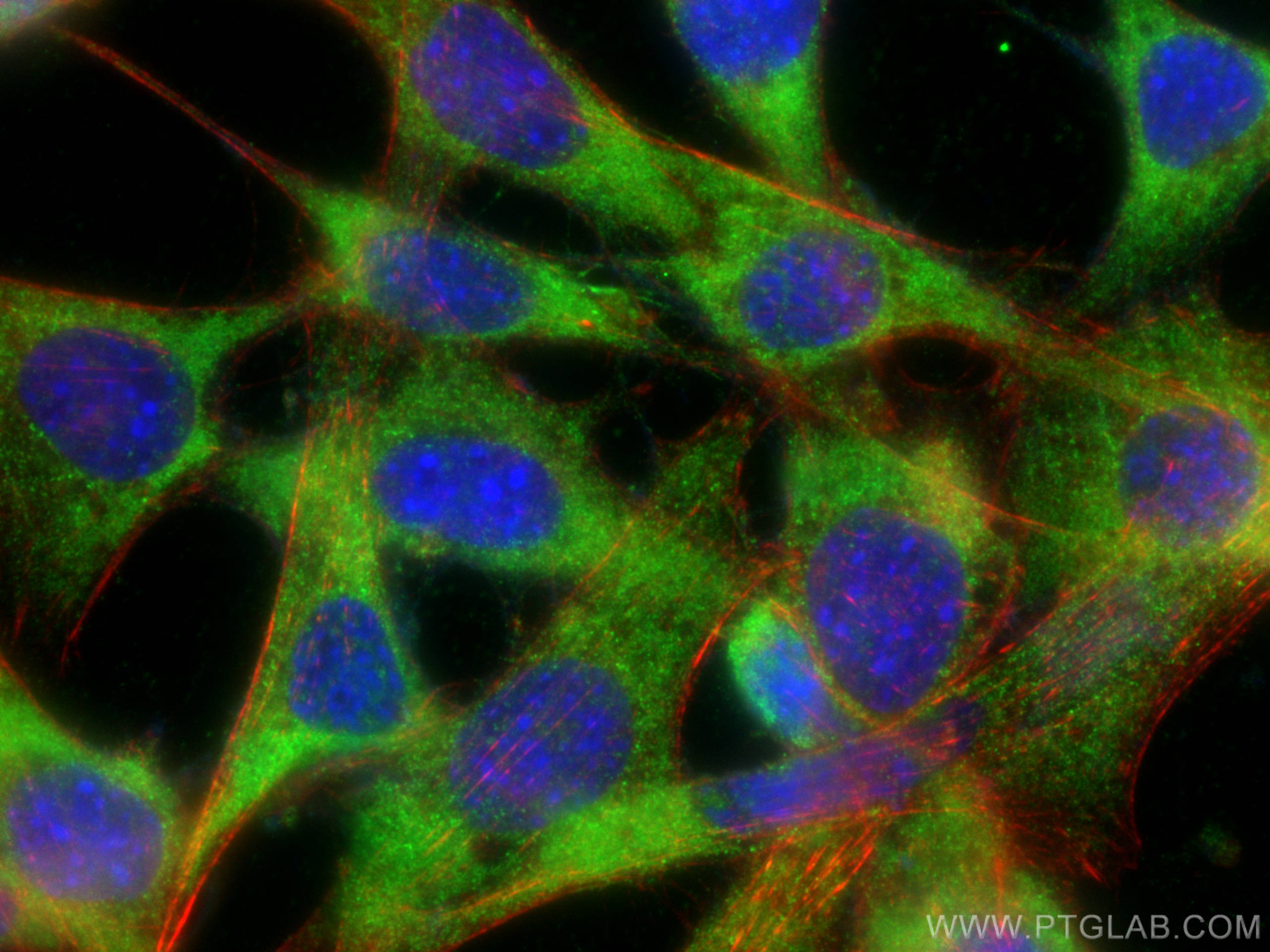 Immunofluorescence (IF) / fluorescent staining of NIH/3T3 cells using SMPD1,ASM Polyclonal antibody (30197-1-AP)