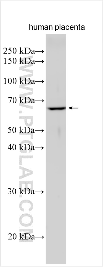 Western Blot (WB) analysis of human placenta tissue using SMPD1,ASM Polyclonal antibody (30197-1-AP)