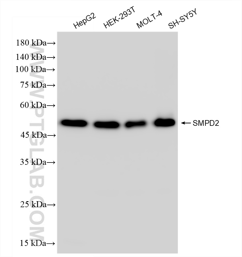 Western Blot (WB) analysis of various lysates using SMPD2 Recombinant antibody (83520-3-RR)