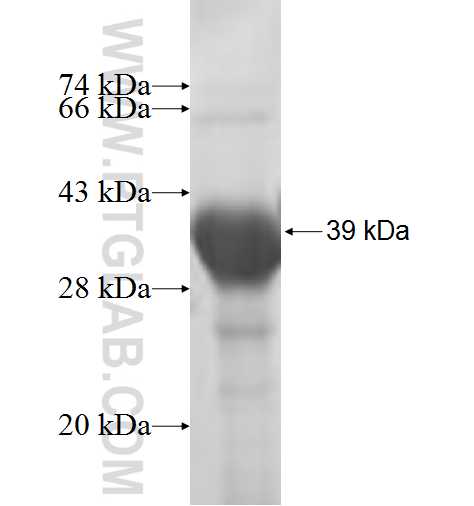 SMPD2 fusion protein Ag7482 SDS-PAGE