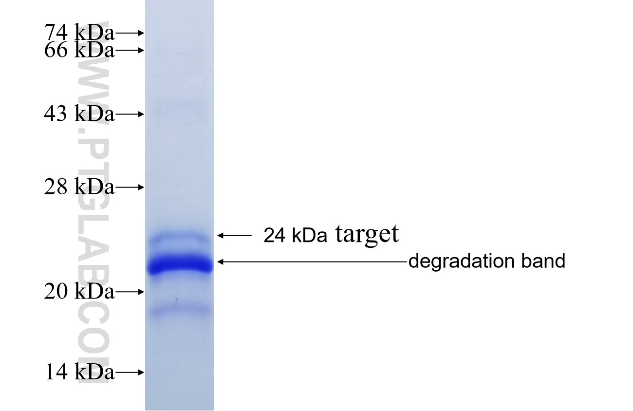 SMPD3 fusion protein Ag22487 SDS-PAGE