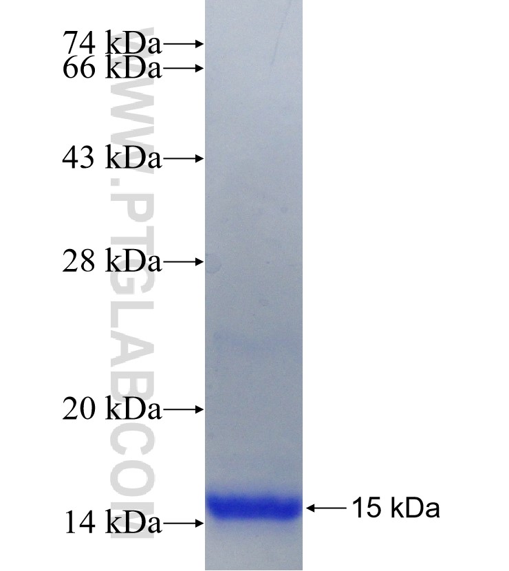 SMR3B fusion protein Ag27336 SDS-PAGE