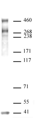 SMRT / NCoR2 antibody (pAb) tested by Western blot. Whole cell extract of HeLa cells (40 ug per lane) probed with SMRT / NCoR2 antibody (pAb) (1:500 dilution).
