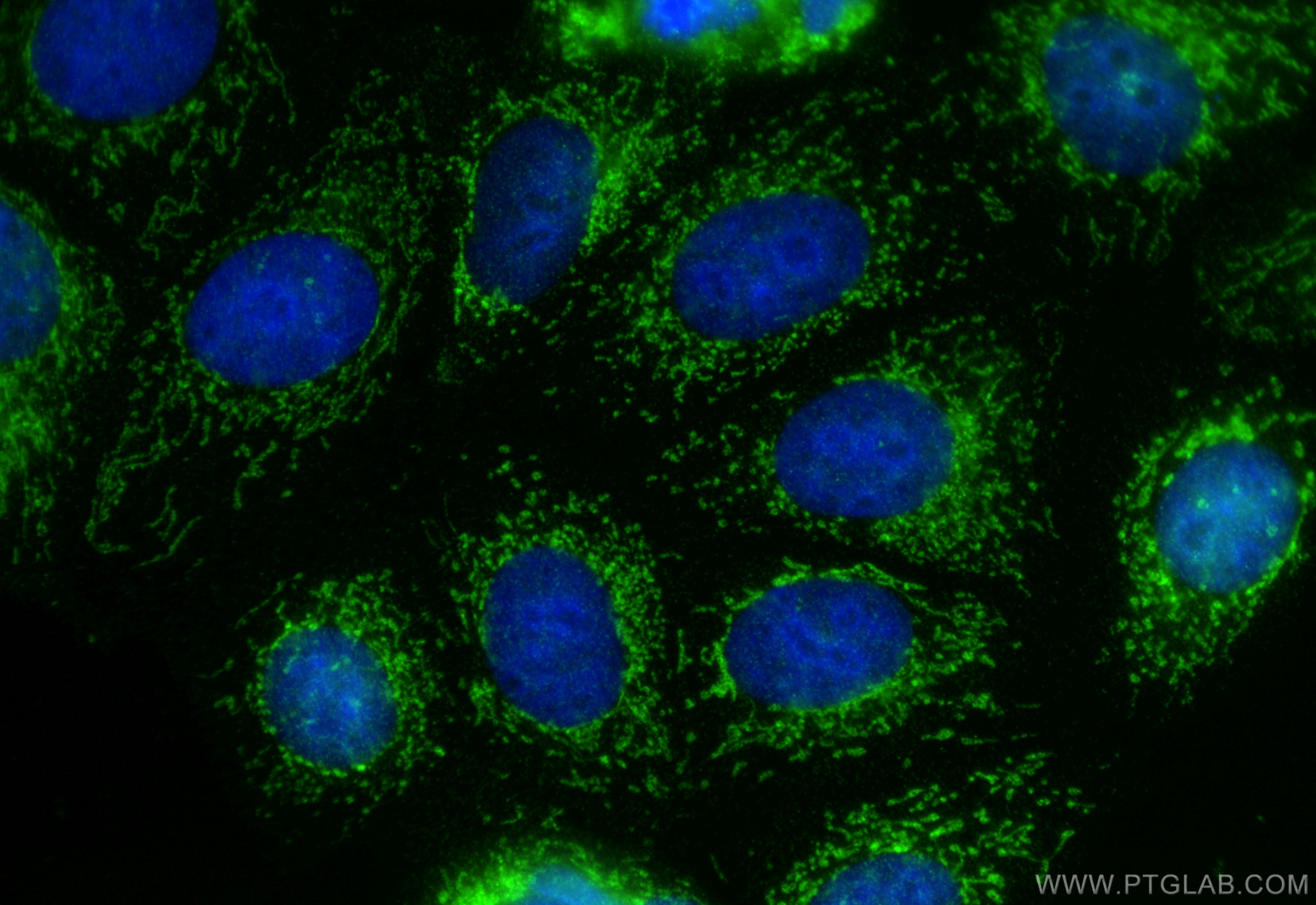 Immunofluorescence (IF) / fluorescent staining of MCF-7 cells using SMTNL2 Polyclonal antibody (14782-1-AP)