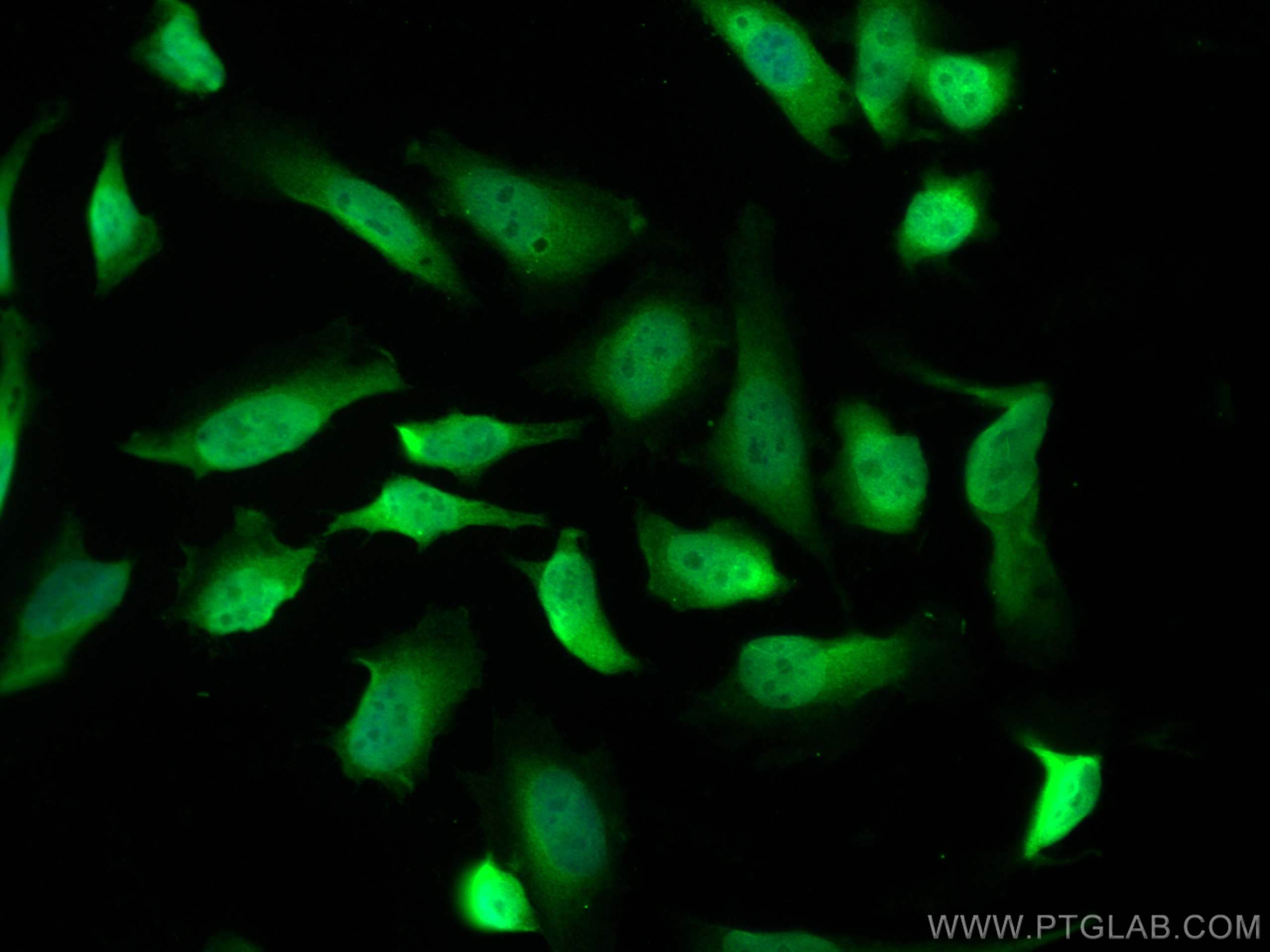 Immunofluorescence (IF) / fluorescent staining of HeLa cells using SNAI1 Polyclonal antibody (26183-1-AP)