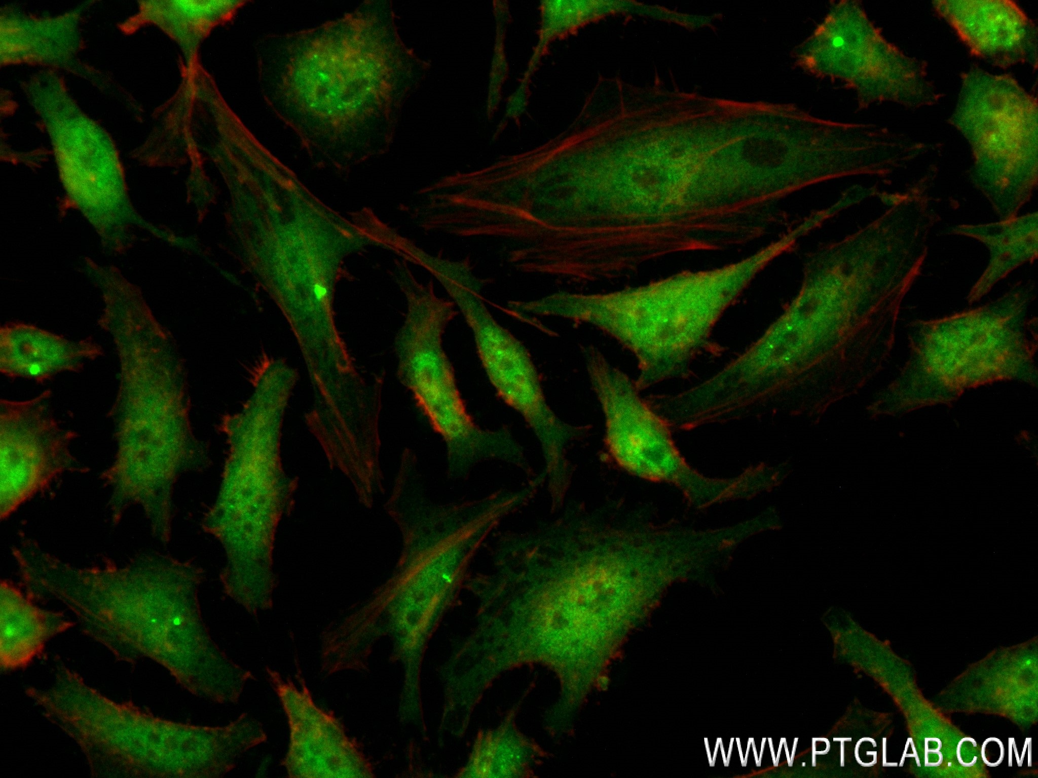 Immunofluorescence (IF) / fluorescent staining of HeLa cells using SNAI1 Recombinant antibody (81584-4-RR)