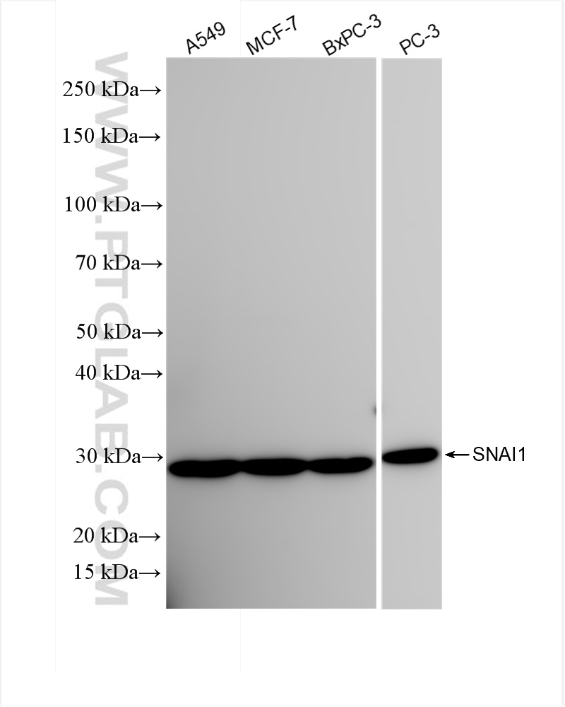 Western Blot (WB) analysis of various lysates using SNAI1 Recombinant antibody (81584-5-RR)