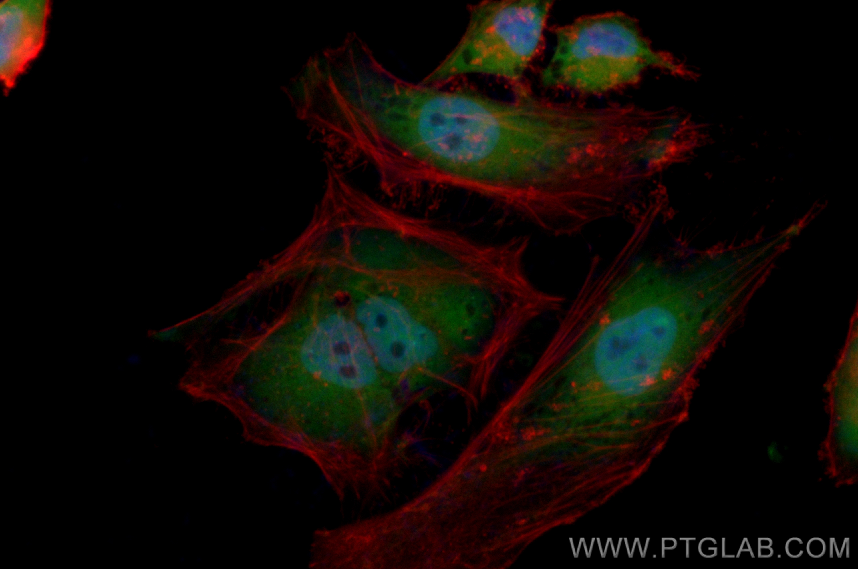 Immunofluorescence (IF) / fluorescent staining of HeLa cells using CoraLite® Plus 488-conjugated SNAI1 Recombinant an (CL488-81584-4)