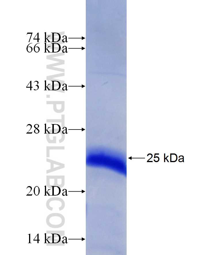 SNAI2 fusion protein Ag29695 SDS-PAGE