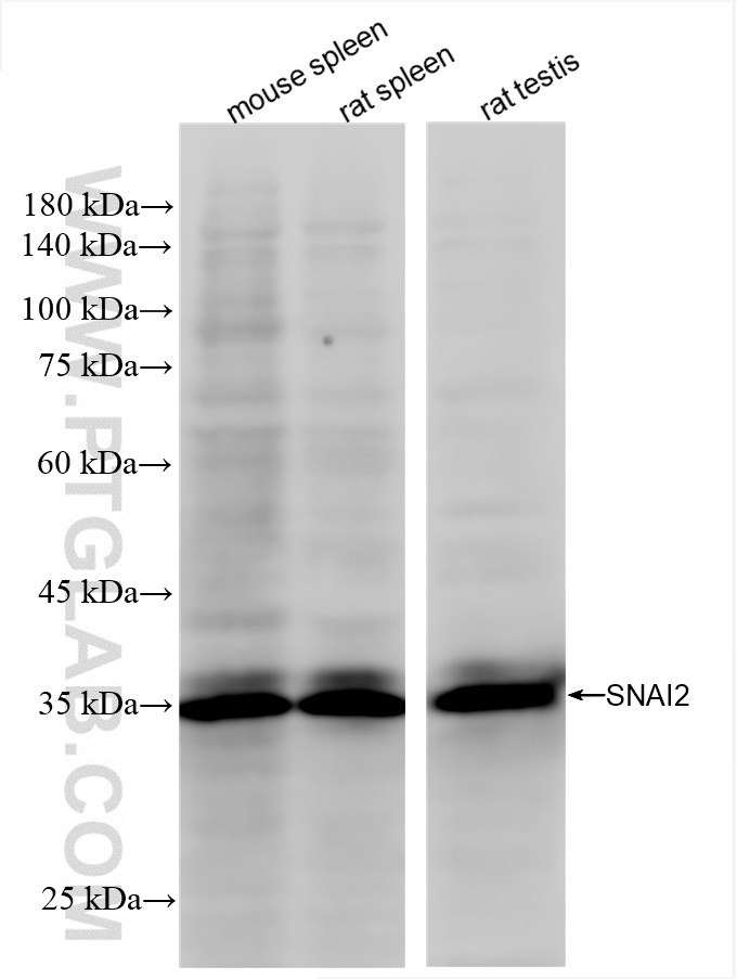 Western Blot (WB) analysis of various lysates using SNAI2/SLUG Recombinant antibody (82755-3-RR)