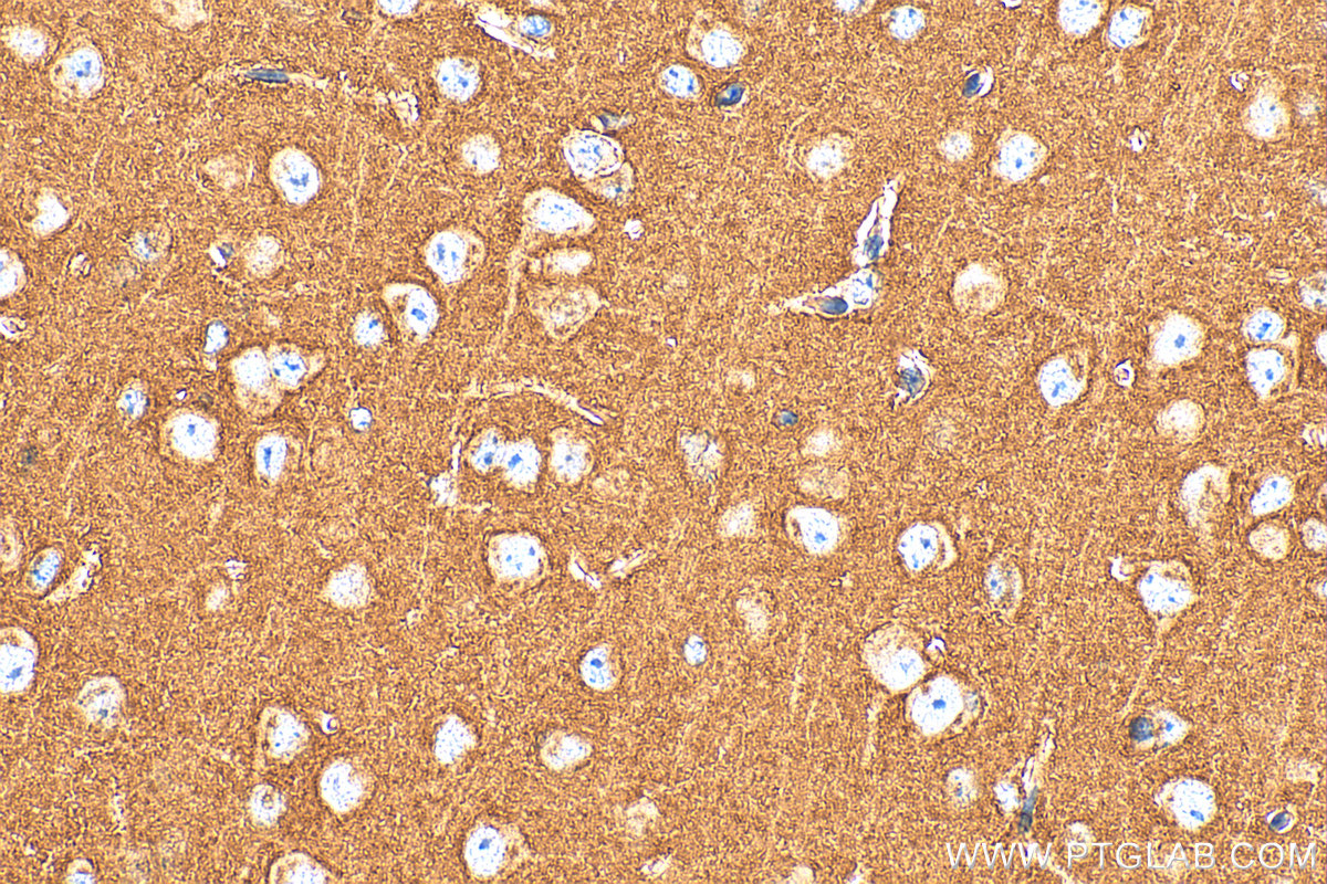 Immunohistochemistry (IHC) staining of mouse brain tissue using SNAP25 Polyclonal antibody (14903-1-AP)