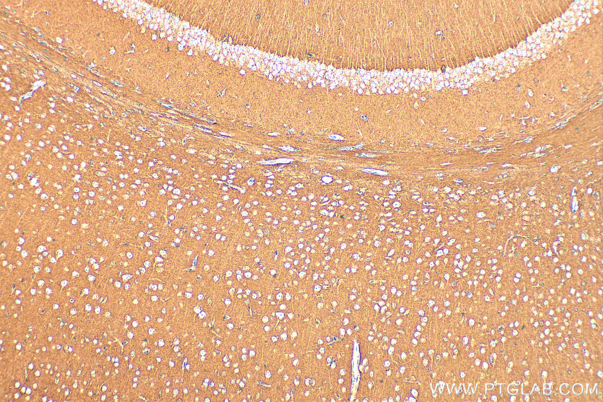Immunohistochemistry (IHC) staining of mouse brain tissue using SNAP25 Polyclonal antibody (14903-1-AP)