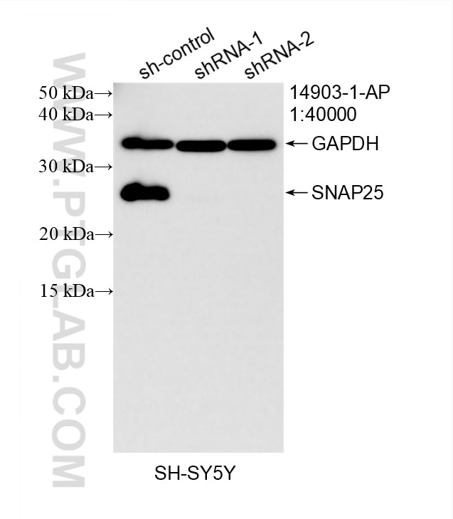 Western Blot (WB) analysis of SH-SY5Y cells using SNAP25 Polyclonal antibody (14903-1-AP)