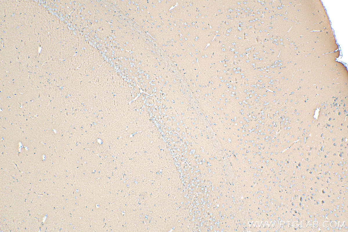 Immunohistochemistry (IHC) staining of mouse brain tissue using SNAP25 Recombinant antibody (83259-1-RR)